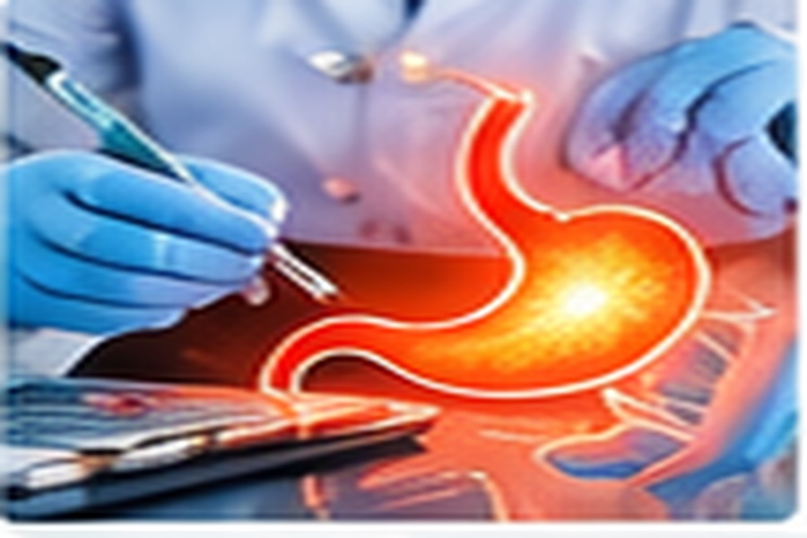 Understanding Acid Reflux: Symptoms, Causes and Management